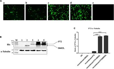 Identification of novel linear epitopes in P72 protein of African swine fever virus recognized by monoclonal antibodies